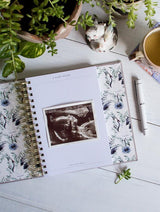 A BUMP | MY PREGNANCY JOURNAL | LIGHT GREY by Write To Me, with a photo of a baby and a plant next to it, capturing the beautiful pregnancy journey.